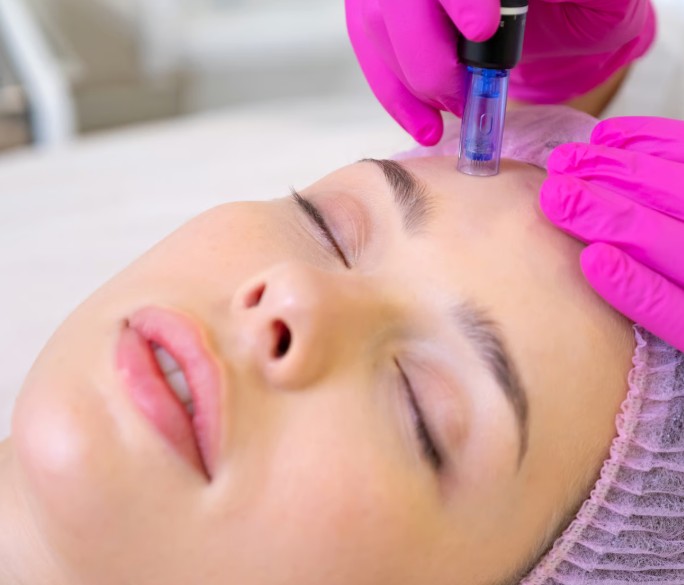 Biorivitalizzazione Milano