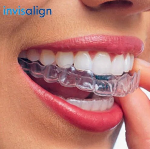 INVISALIGN