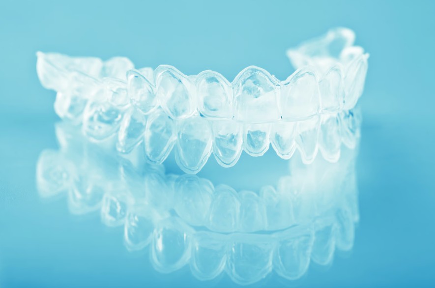 Allineatore dentale