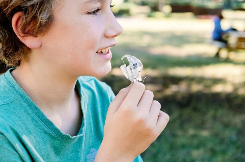 Apparecchi ortodontici per bambini: intercettare e guidare la crescita
